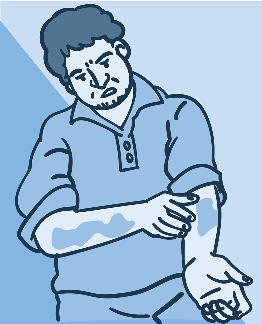 Illustration of a man looking at a rash on his arms.